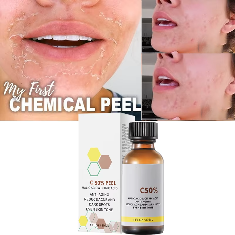 Tranexamic Acid Serum - With Malic Acid And Citric Acid