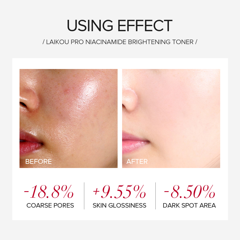 LAIKOU PRO Niacinamide 4Pcs Br - огляд і ціна Skincare Oily Skin