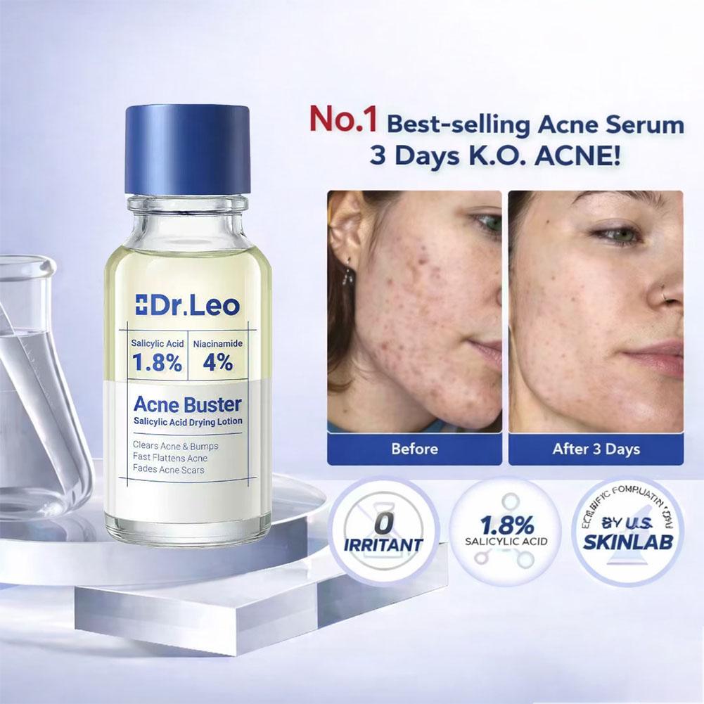 Salicylic Acid Essence Treatme - огляд і ціна Tranexamic Acid Serum