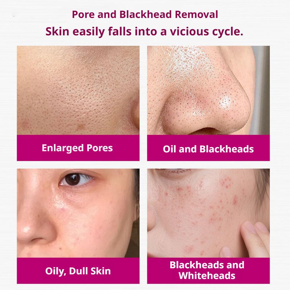 Salicylic Acid Shrink Pores Se - огляд і ціна Tranexamic Acid Serum