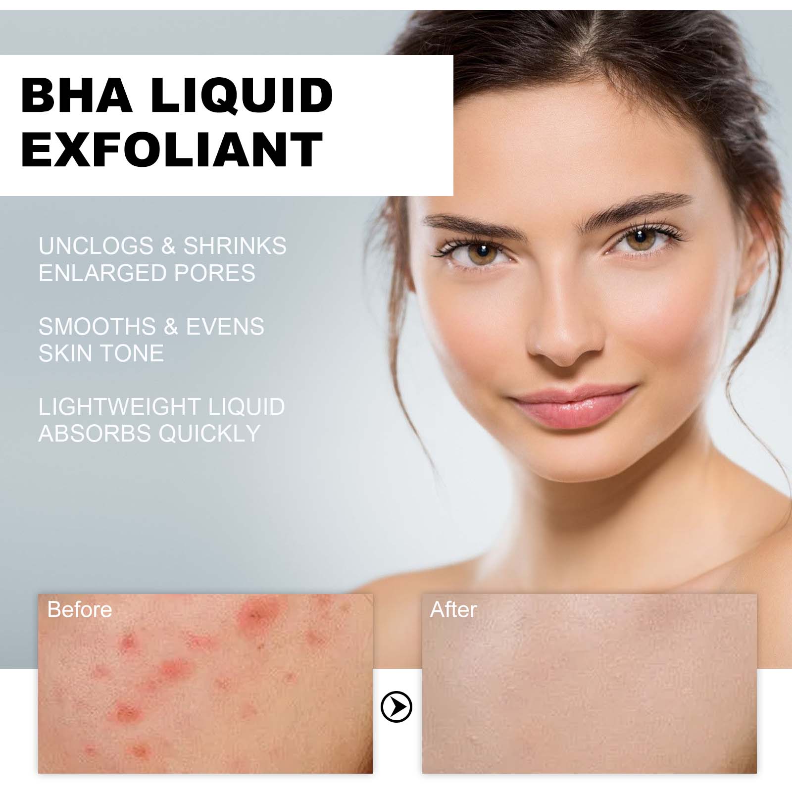 2% Salicylic Acid Liquid Exfol - огляд і ціна Tranexamic Acid Serum
