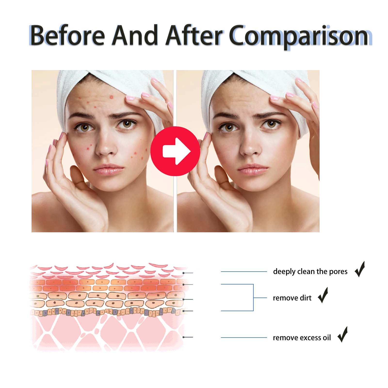 2% Salicylic Acid Liquid Exfol - огляд і ціна Tranexamic Acid Serum
