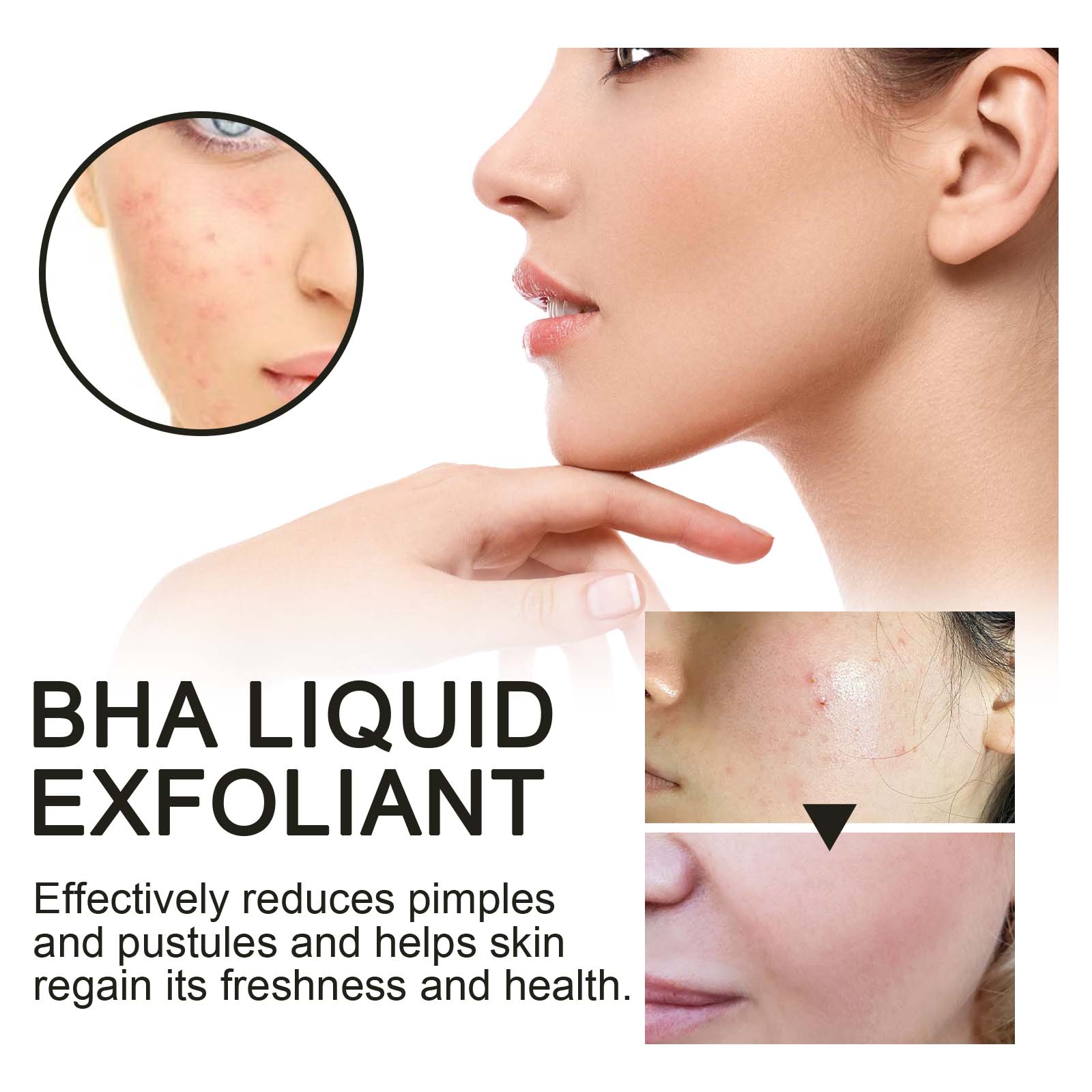 2% Salicylic Acid Liquid Exfol - огляд і ціна Tranexamic Acid Serum