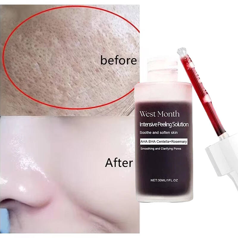Feels Like Silk, Looks Like Fi - огляд і ціна Tranexamic Acid Serum