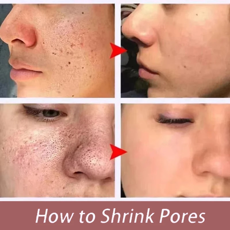 Feels Like Silk, Looks Like Fi - огляд і ціна Tranexamic Acid Serum