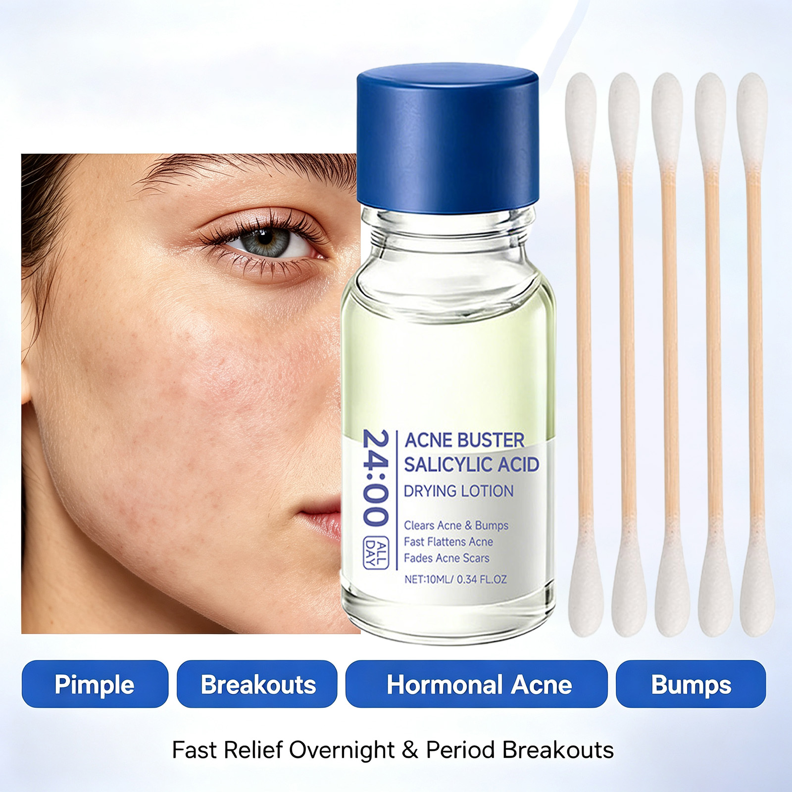 Salicylic Acid Acne Treatment  - огляд і ціна Tranexamic Acid Serum