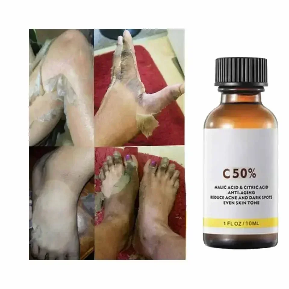 With Malic Acid And Citric Aci - огляд і ціна Tranexamic Acid Serum